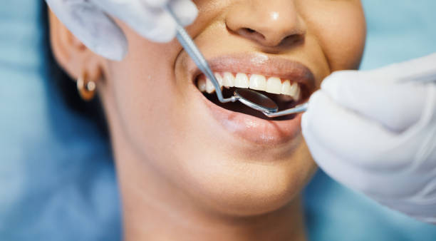 Best Emergency Dental Extractions in North Olmsted, OH
