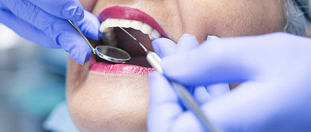 Best Weekend Emergency Dentist in North Olmsted, OH